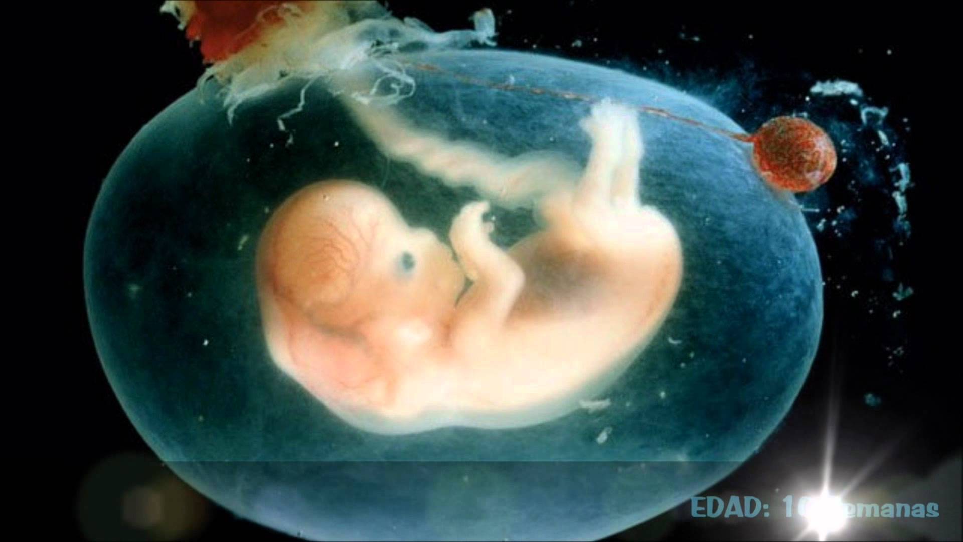 Planned Parenthood comercia con los cuerpos de los niños abortados