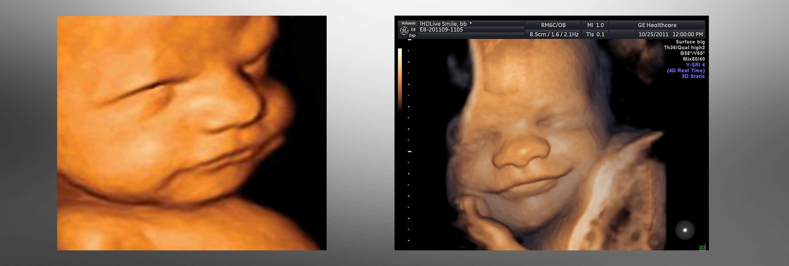 La vida: siempre bienvenida